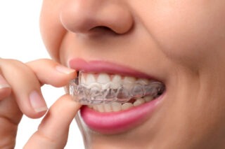 Free Orthodontist consultation Las Vegas