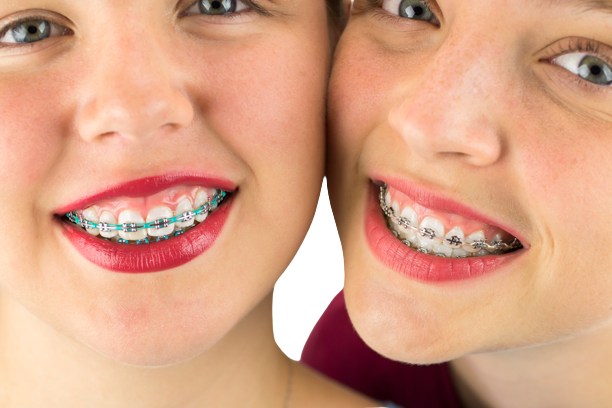 Best Affordable Las Vegas Orthodontists